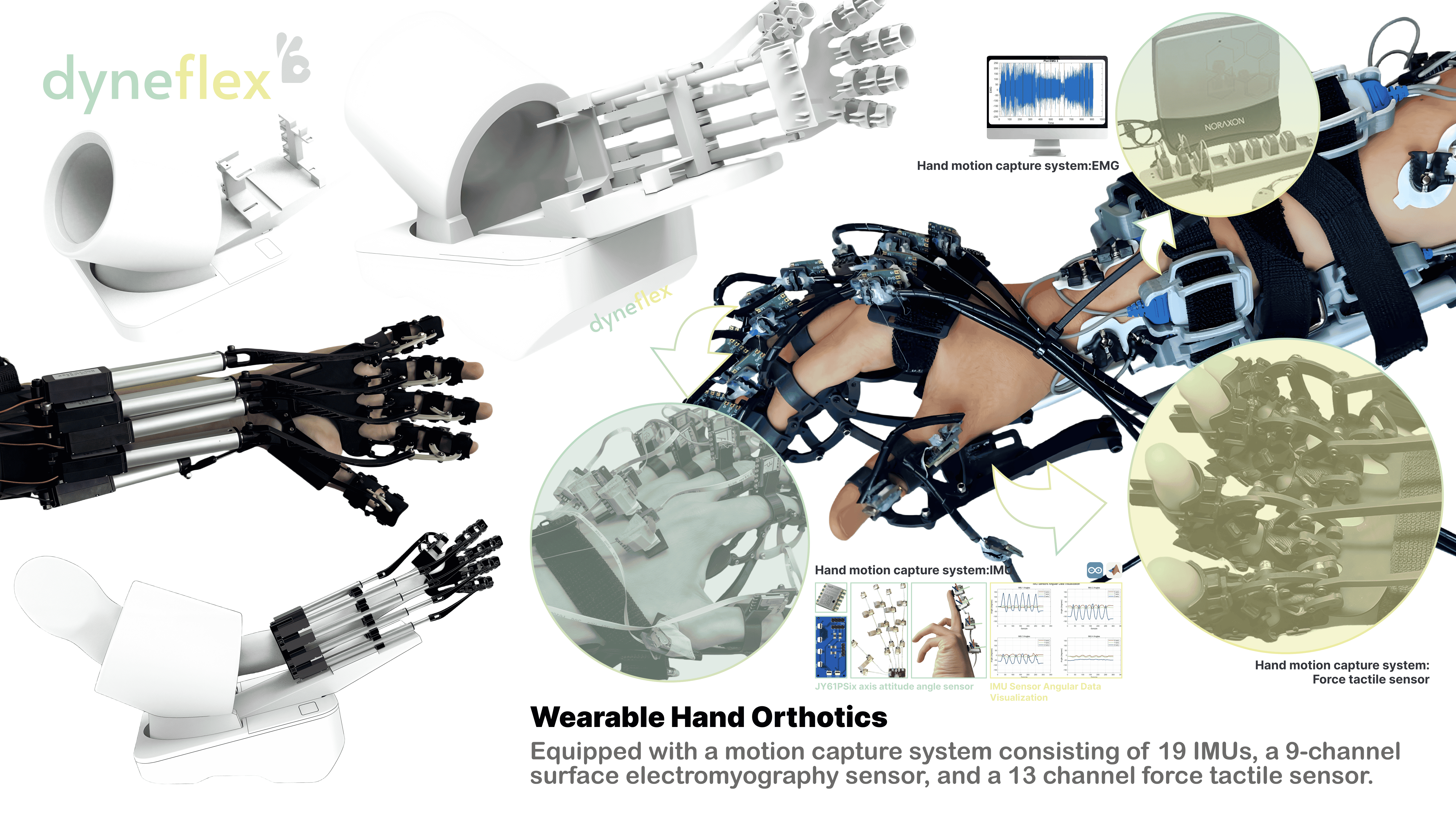 戴森设计大奖dyneflexhand-rehabilitation-orthotics-and-dynamic-spasm-monitoring-methodsp3产品外观渲染图硬件穿戴效果.png